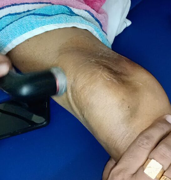 Osteopathy Treatment for Knee Pain in Maruti Vihar